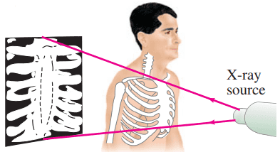 Conventional X-ray imaging, which is essentially shadowing.